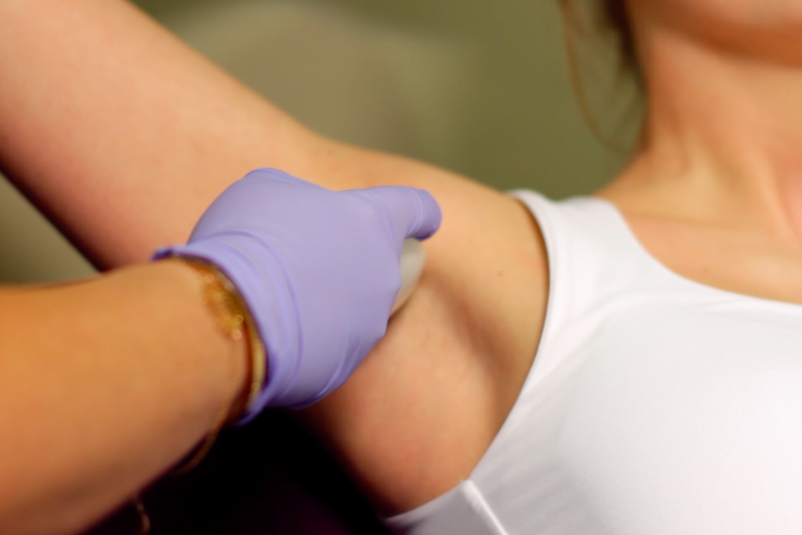 Laser hair removal for women-underarm area
