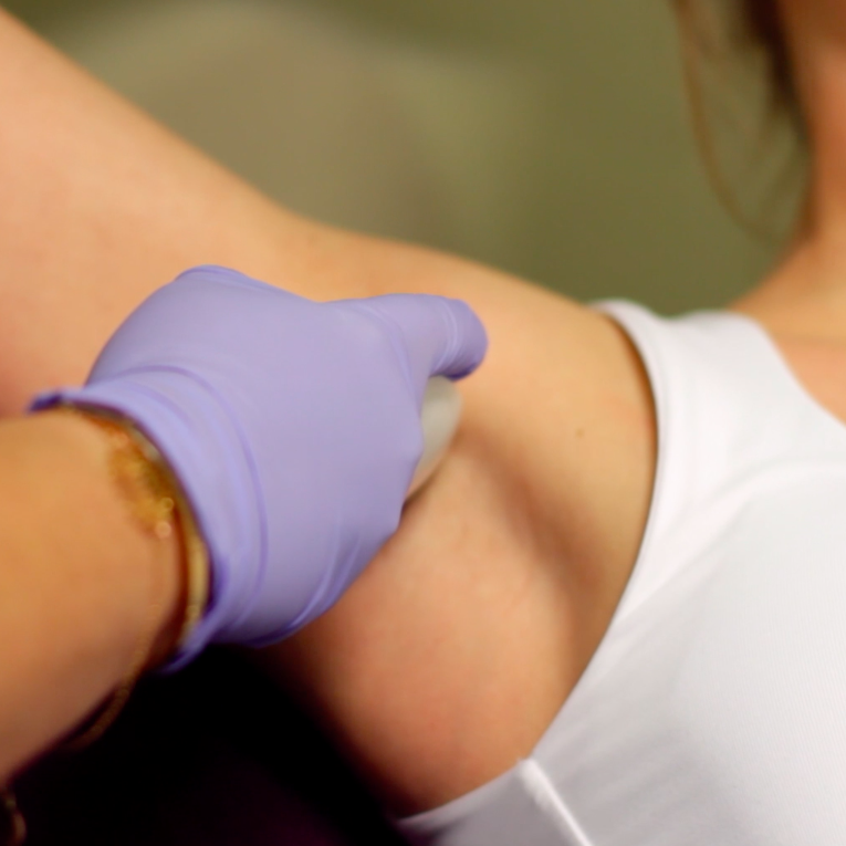 Laser hair removal for women-underarm area