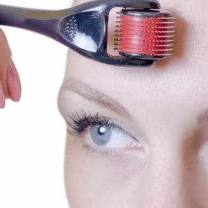 Our services- Derma roller