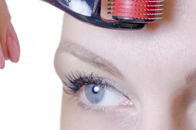 Our services- Derma roller