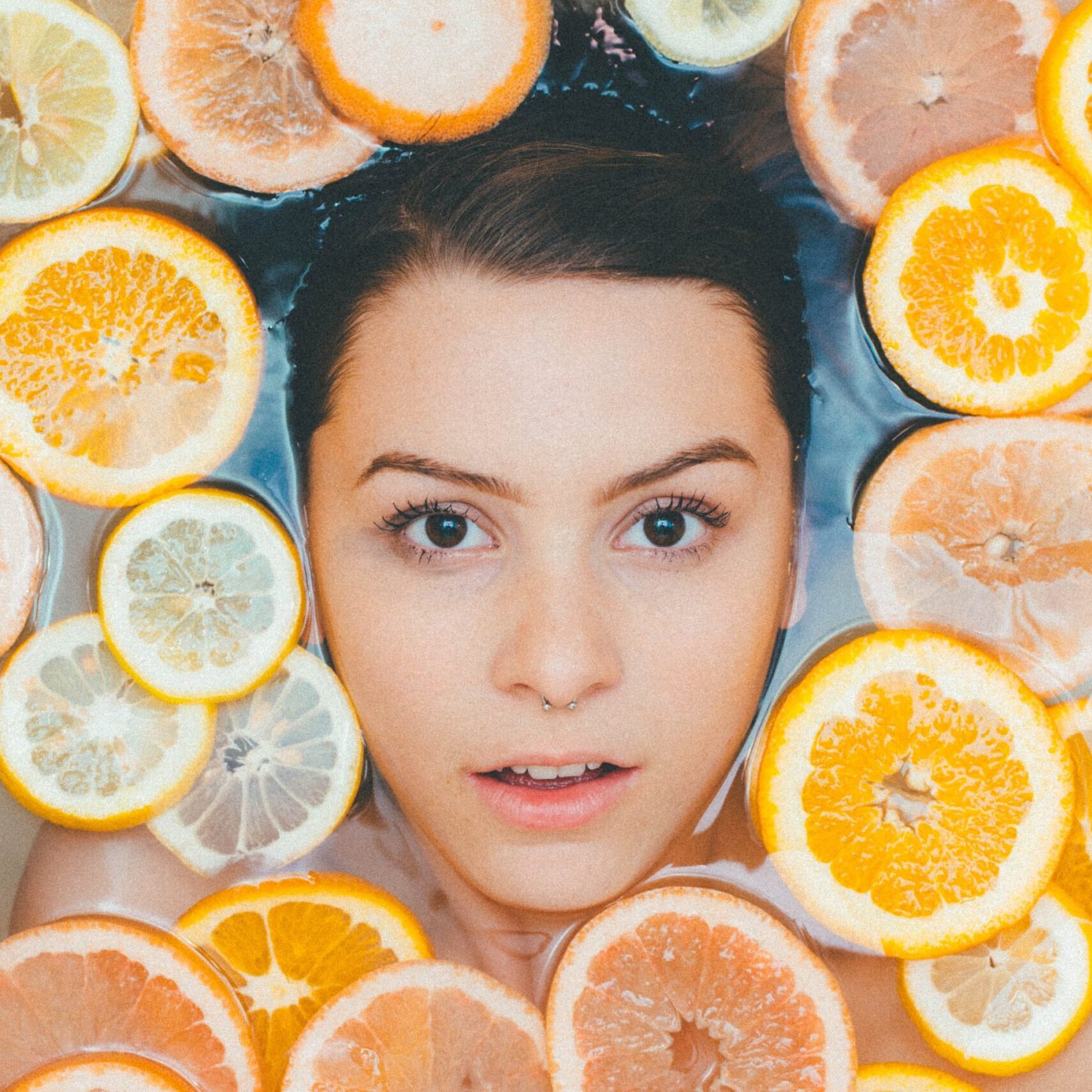 Wrinkles and fine line treatment at Laserpod, London