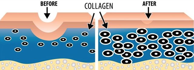 Collagen diagram