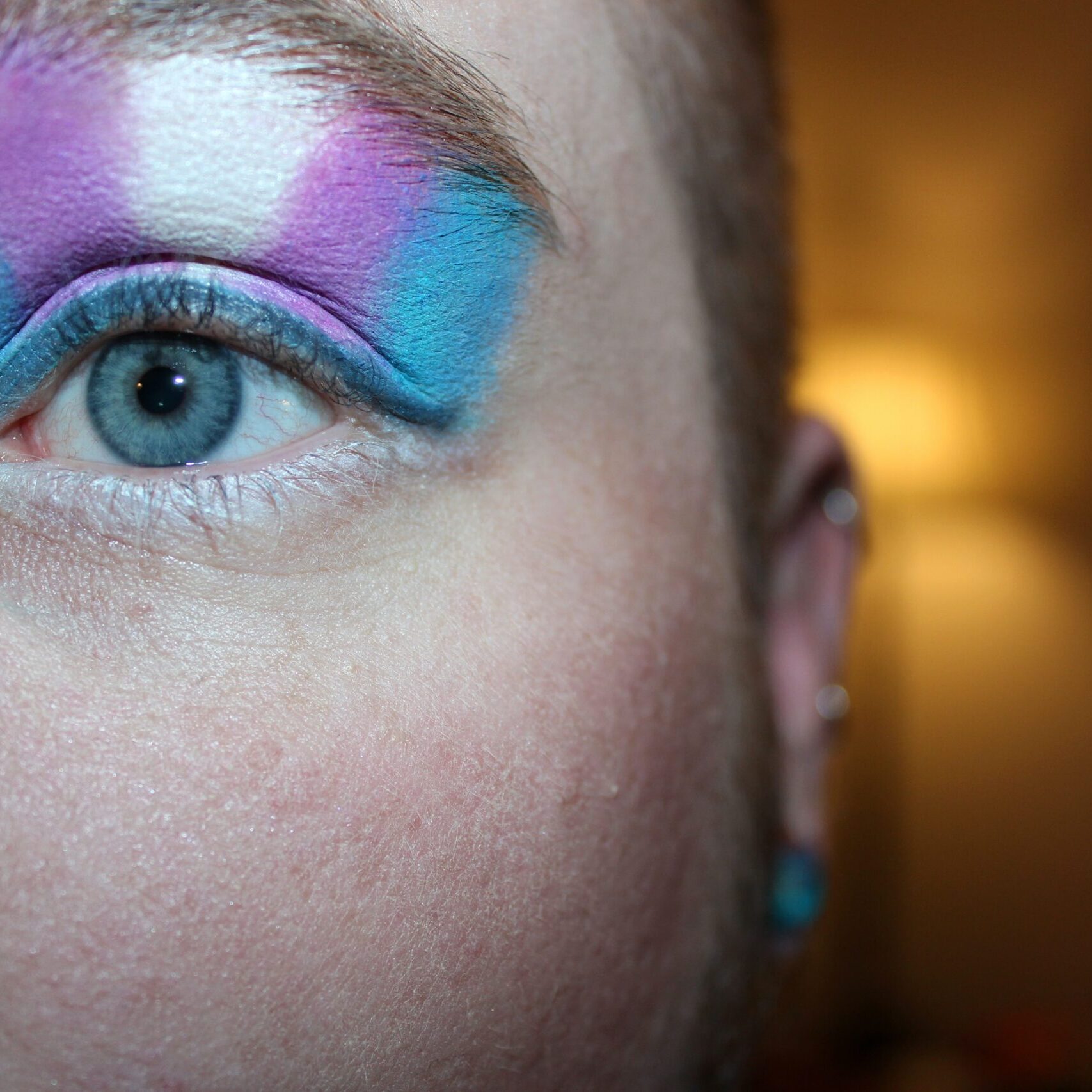 Transgender hair removal