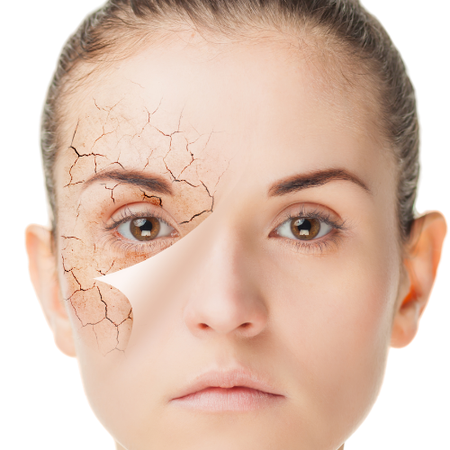 Free skin assesment- Moorgate